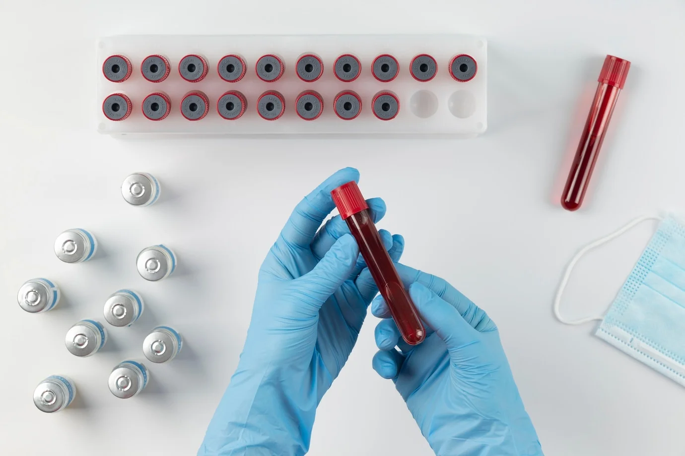 Hands holding a blood vial sample