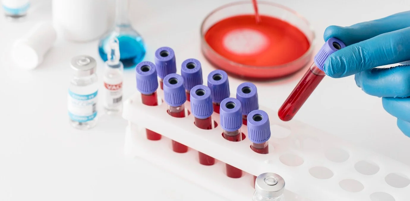 Laboratory blood testing and vials