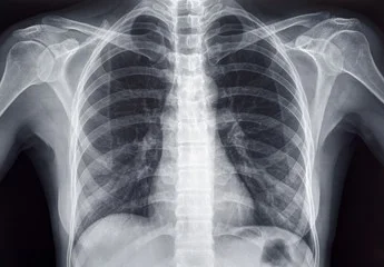 Patient undergoing a medical X-ray procedure with a radiographer